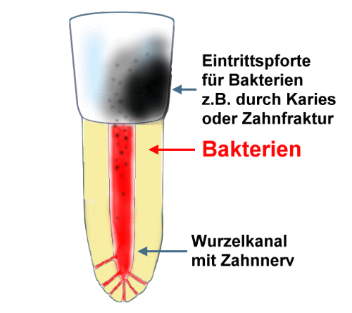 EndoUrsache02