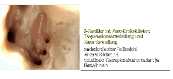 Adidas Evil Eye Youtube